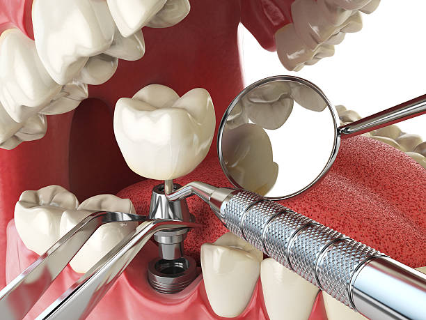 Best Emergency Dental Surgery in Level Plains, AL